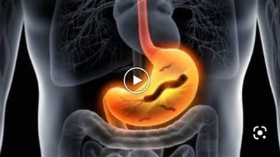 أعراض القولون العصبي وجرثومة المعدة وطرق علاجهما