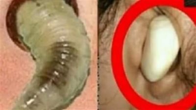 انظر ماذا سيحدث عندما تضع البصل في هذه المنطقة من جسمك !!