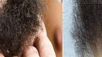 الواجب على من لا يستطيع حلق عانته، والشعور التي تجب إزالتها