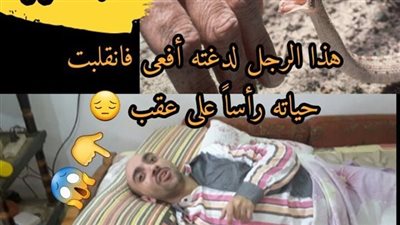 قصة الرجل الذي لدغته أفعى قصة حقيقية وواقعية وليست من وحي الخيال