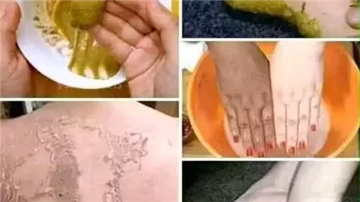 خلطة تبييض الوجه والجسم للأبد في ثواني! كيفيه الحصول علي بشړة بيضاء كالتلج وصافيه كأزجاج
