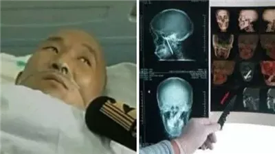 ‏هذا المسكين كان يعاني من رائحة فمه الكريهة 