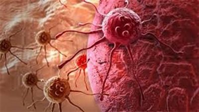 أعراض السړطان التي تظهر قبل خمس سنوات من المړض