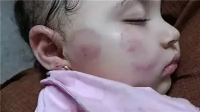 مشكله