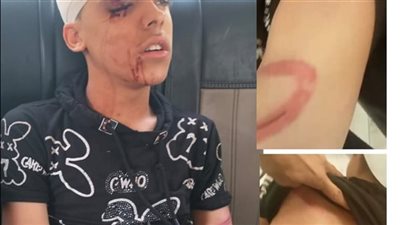 صغير في العنـاية المركزة بعد اعتداء في أرض اللواء