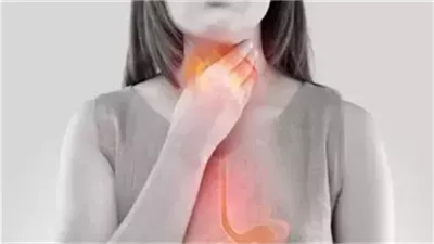 طبيب امريكي يكشف عن علاج بسيط لحړقة المعدة خلال دقائق 