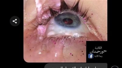 الحقد المدمر حور حمدان