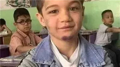 القضيه