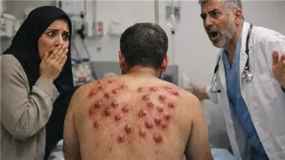 وجدتُ ثلاثين بقعة حمراء على ظهر زوجي تشبه بيض الحشرات