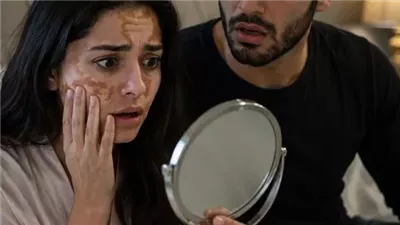 مرض مراتي ١ حكايات زهرة